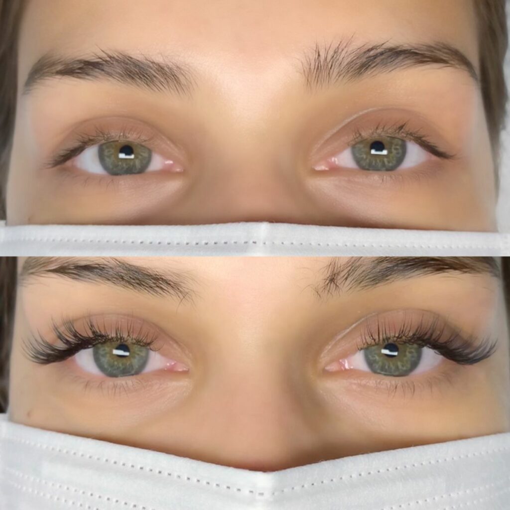 before and after classic lash extensions